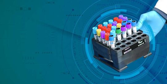 Minimizing Laboratory Errors with Automation