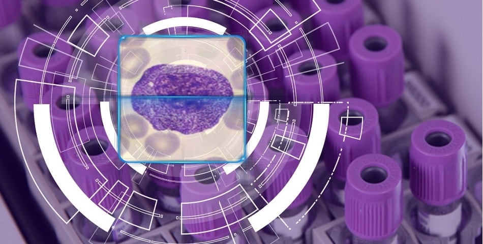 Improving hematology workflow efficiency through flagging optimization
