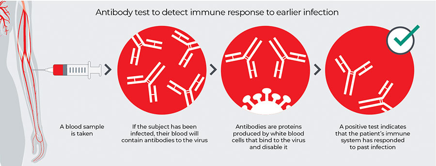A chart to identify how IgG and IgM antibody tests work 