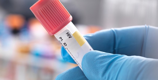 The evolution of high-sensitivity HIV diagnostic testing