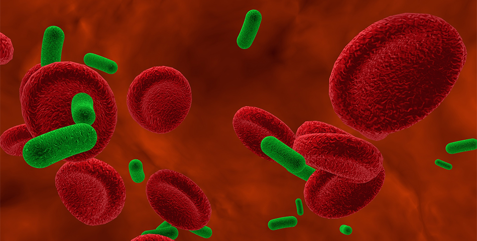 Micro sepsis header