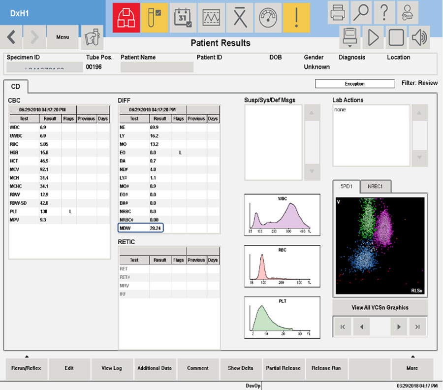 Hematology analyzer reporting MDW parameter