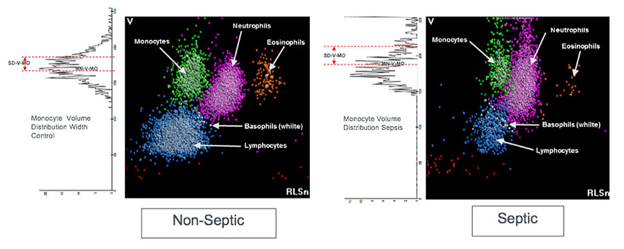 Effect of sepsis on monocyte size