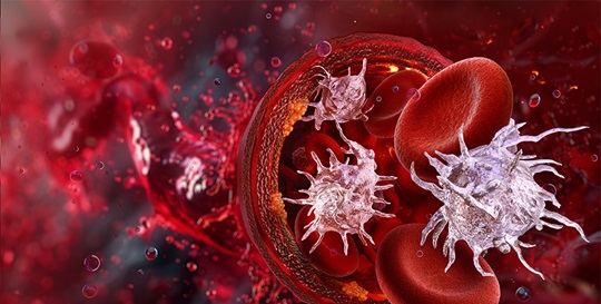 The Value of Mean Platelet Volume (MPV) in Hematology