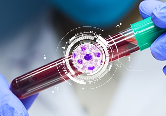 Unlocking SEPSIS Assessment with MDW Parameter