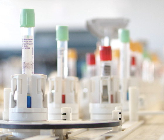 DxA 5000 What Drives You