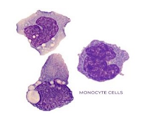 Monocyte Distribution Width