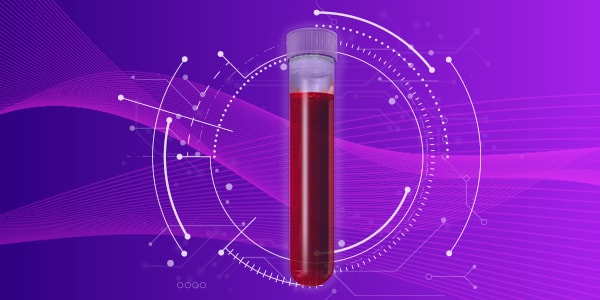 Pioneering digital hematology