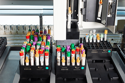Tubes of various heights and cap colors loaded in racks for DxA 5000 inspection