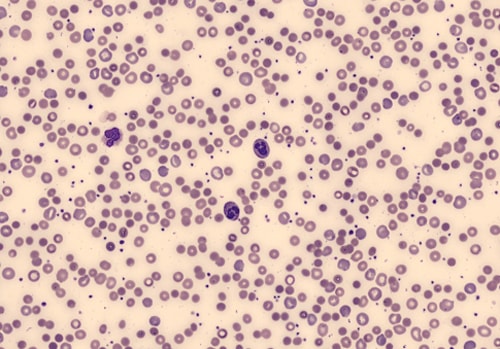Hematology Research Parameters | Beckman Coulter
