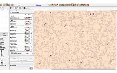 Download cellvision drivers Download cellvision drivers