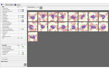 Cellvision Driver Download Cellvision Driver Download