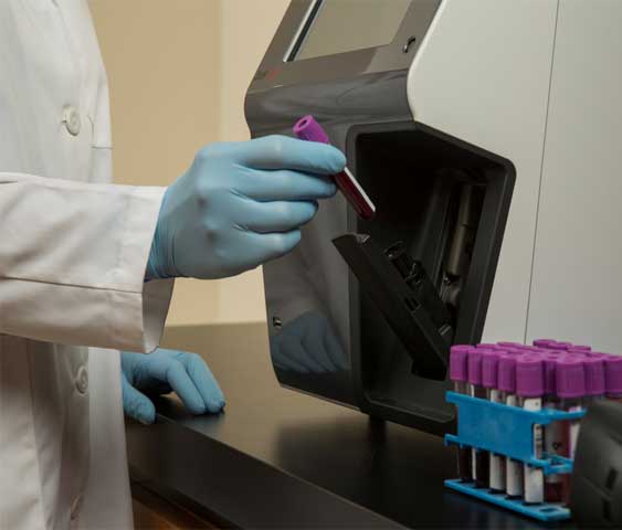 dxh beckman coulter