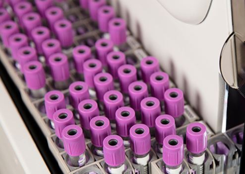 DxH 900 output buffer with cassettes purple tubes DxH 900 output buffer with cassettes purple tubes