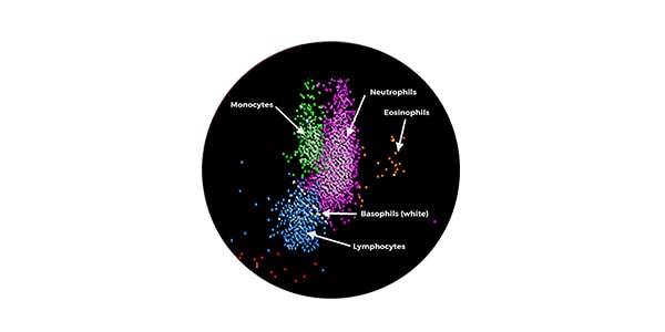 MDW host response biomarker of sepsis risk