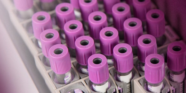 Purple hematology test tubes CBC differential test purple tubes