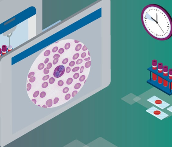 Hematology_SolutionCard_563x480