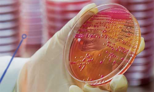 Cultivo de bacterias de microbiología