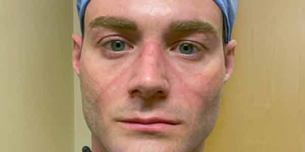 Avery Schmidt, Emergency Room Nurse