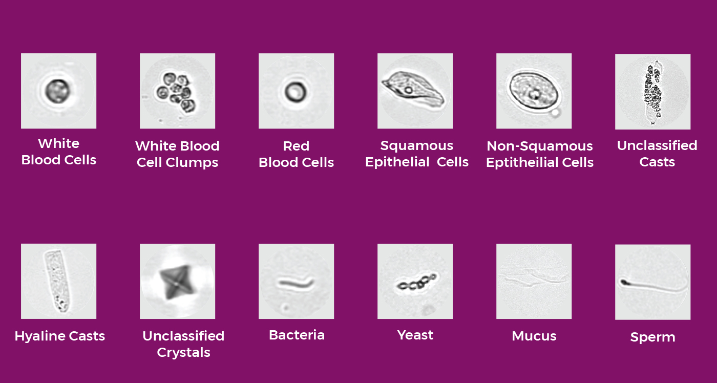 Automated Urinalysis Solution DxU Iris | Beckman Coulter