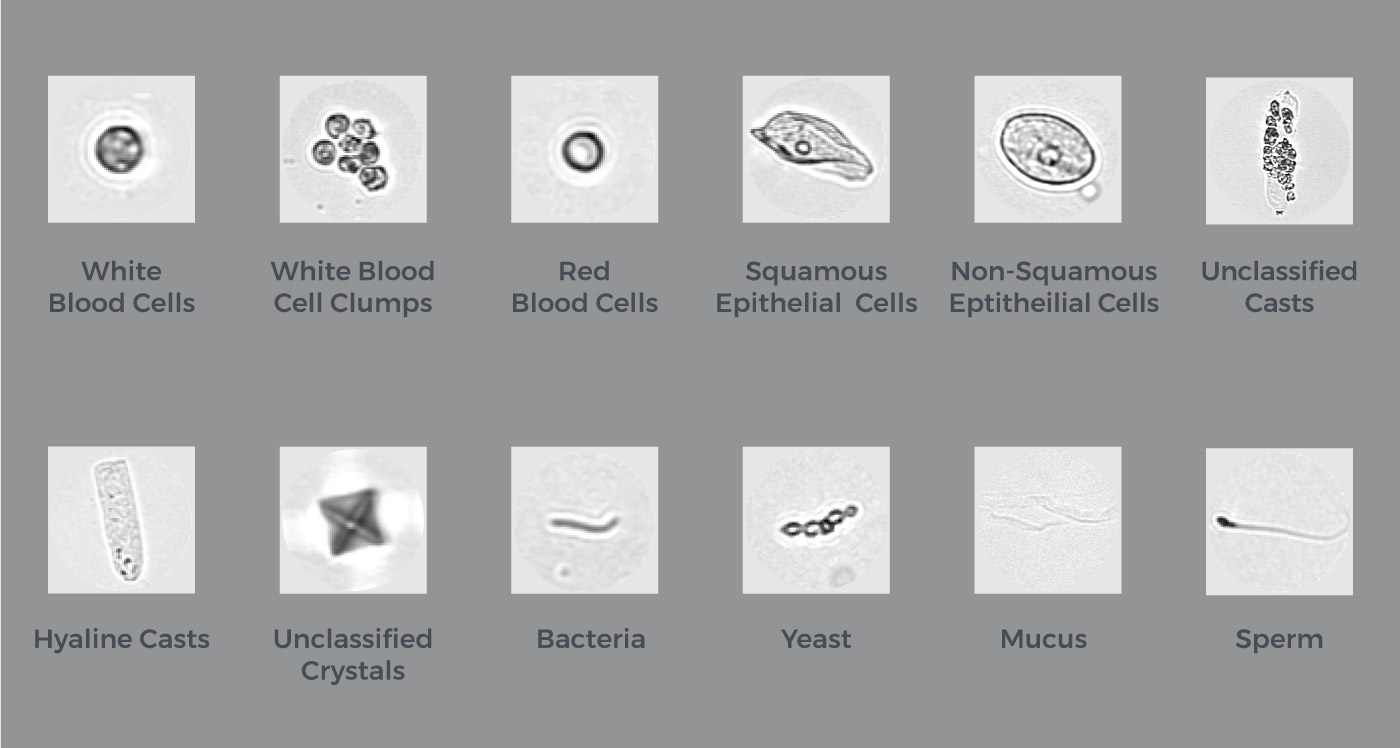 Primary categories include Red Blood Cells (RBC), White Blood Cells (WBC), WBC clumps, Squamous Epithelial Cells, Non-squamous epithelial cells, Hyaline casts, Unclassified casts, Crystals, Bacteria, Yeast, Sperm and Mucus.