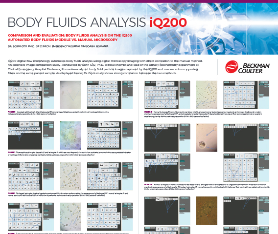 Streamlined Body Fluid Analysis | Beckman Coulter Streamlined Body Fluid Analysis | Beckman Coulter