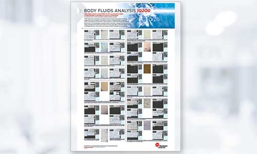 Body Fluids Analysis iQ200 Poster